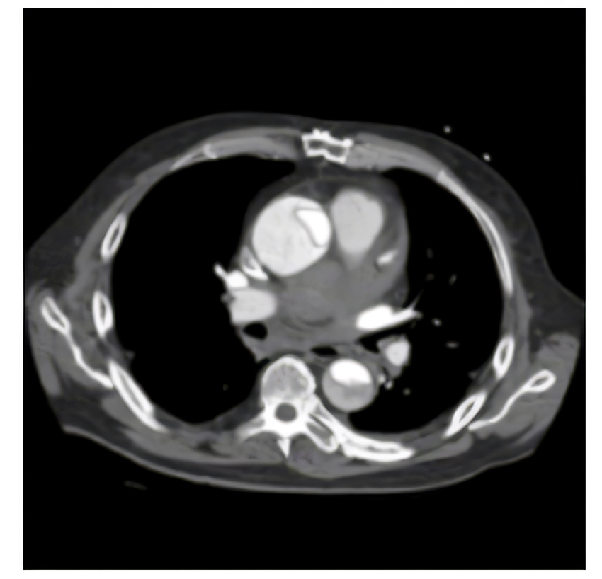 x-ray