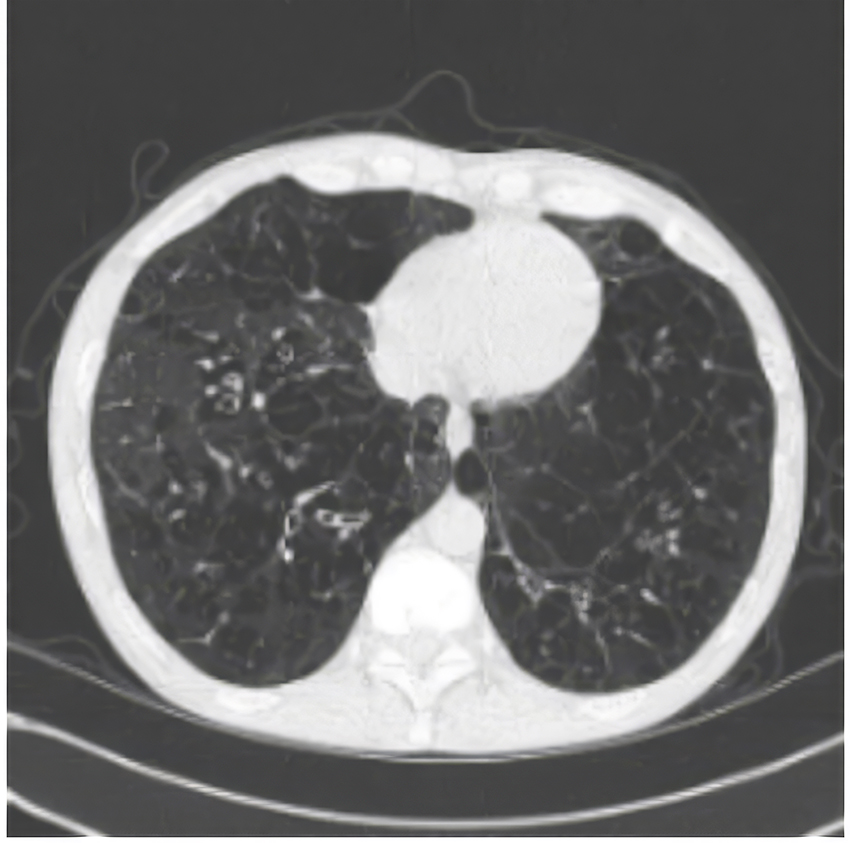 xray