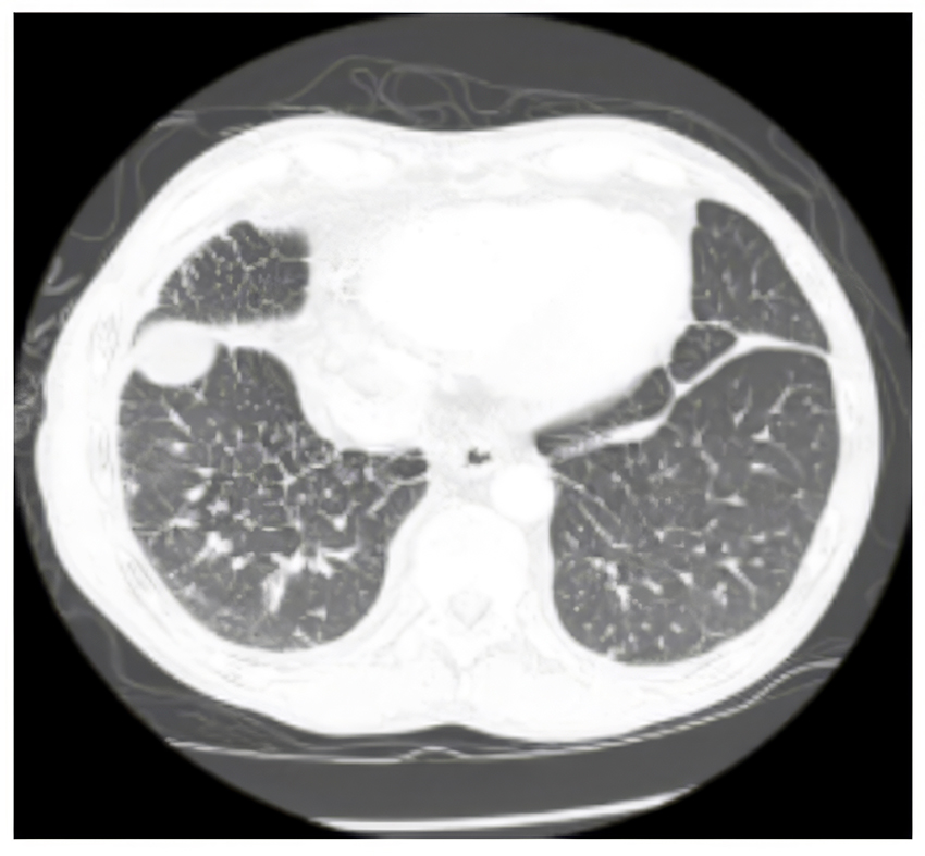 xray