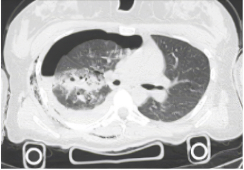 xray