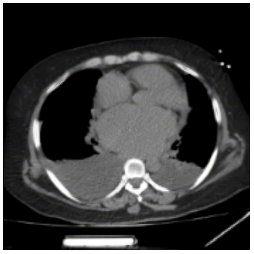 xray