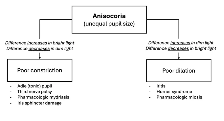Anisocoria graphic