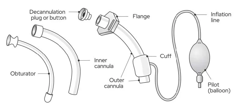 Diagram of Tracheostomy Tube.