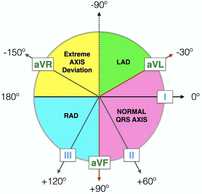 A pie chart illustrating the Axis